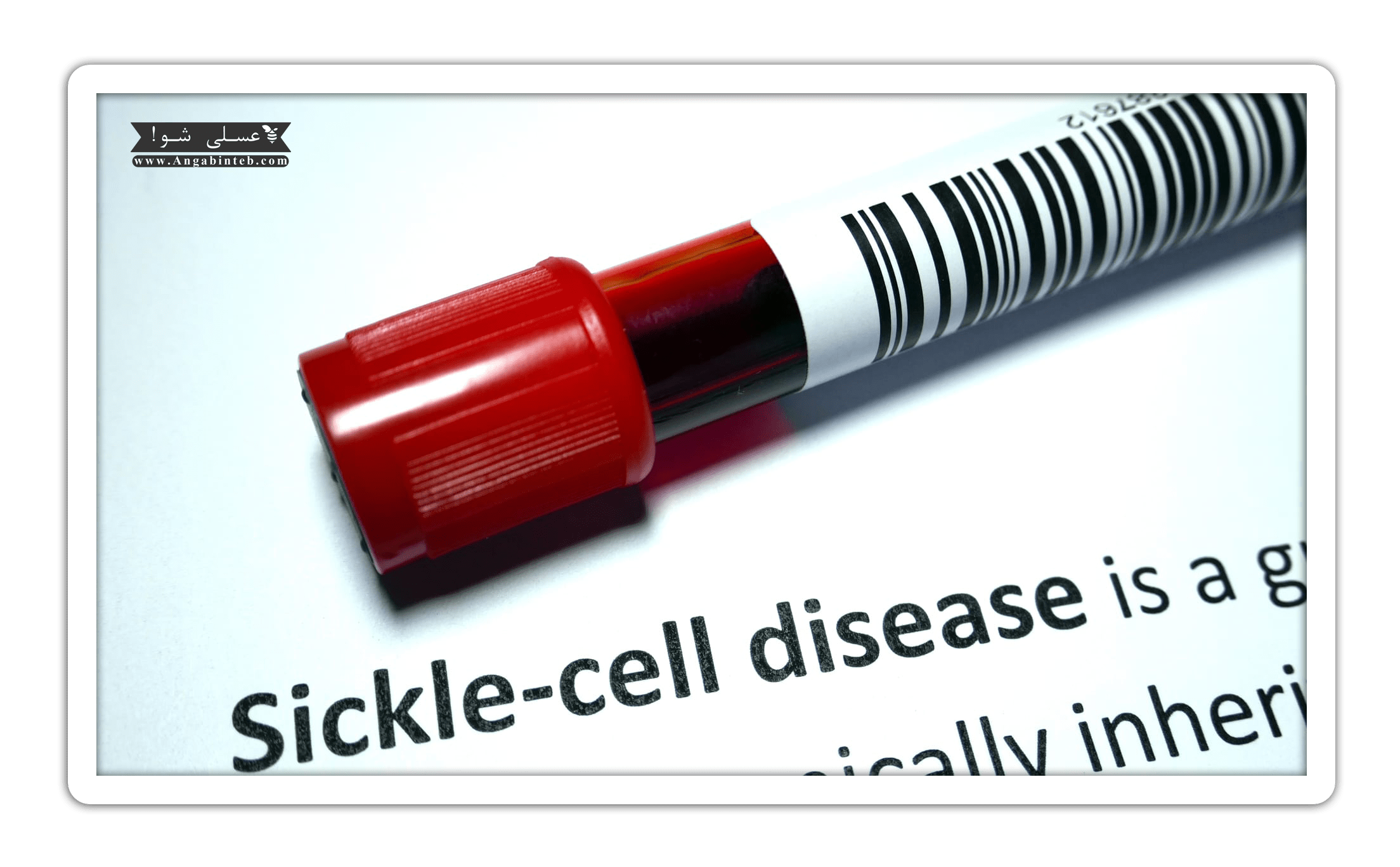 Sickle cell anemia-test